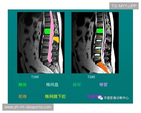 青少年足球运动员骨骼肌肉系统医学保护方案构建